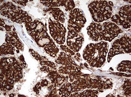 OTC Antibody in Immunohistochemistry (Paraffin) (IHC (P))