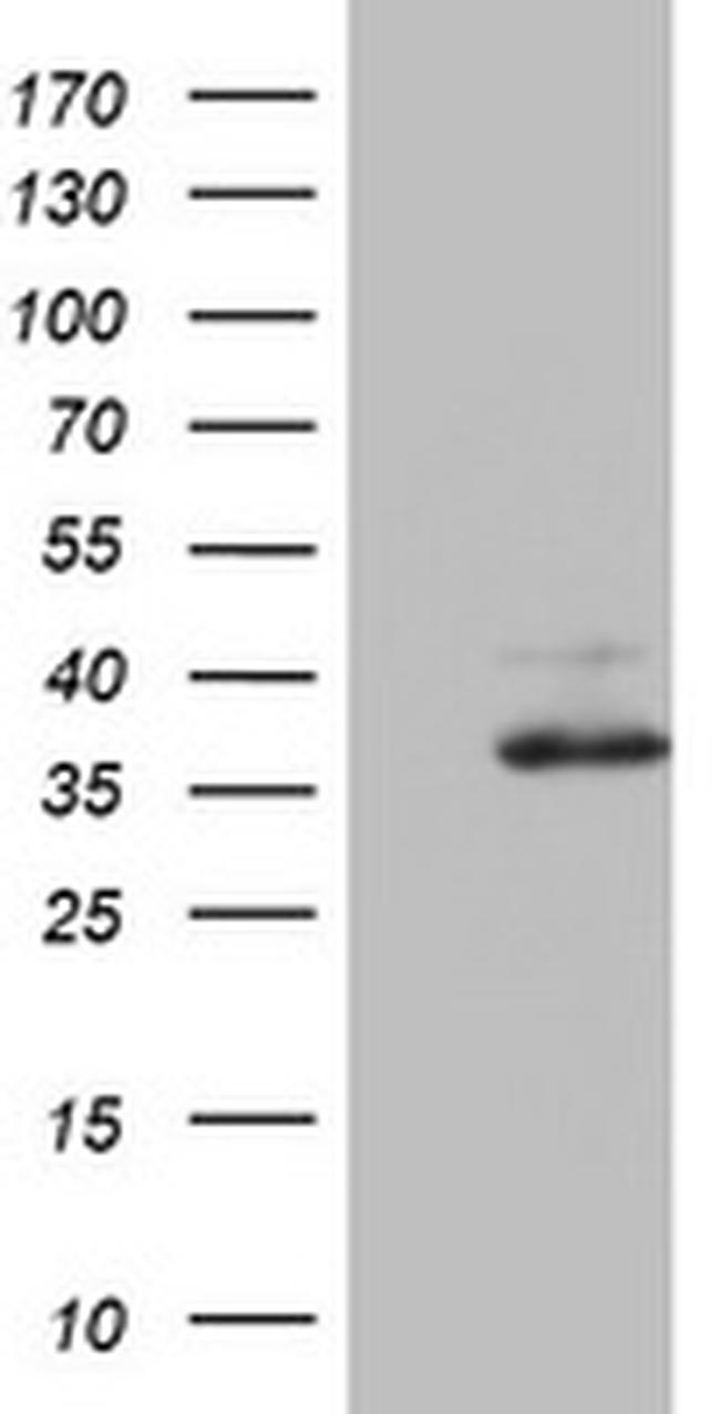 OTC Antibody in Western Blot (WB)