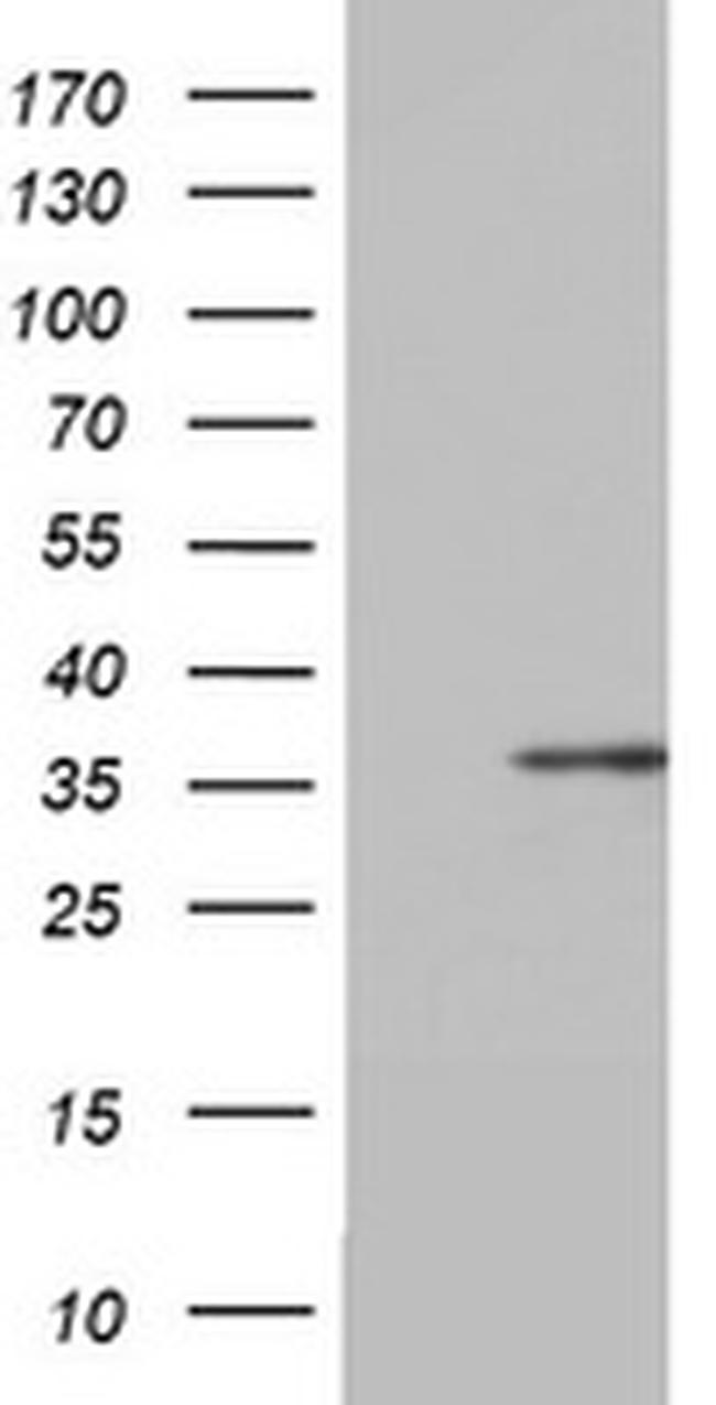 OTC Antibody in Western Blot (WB)