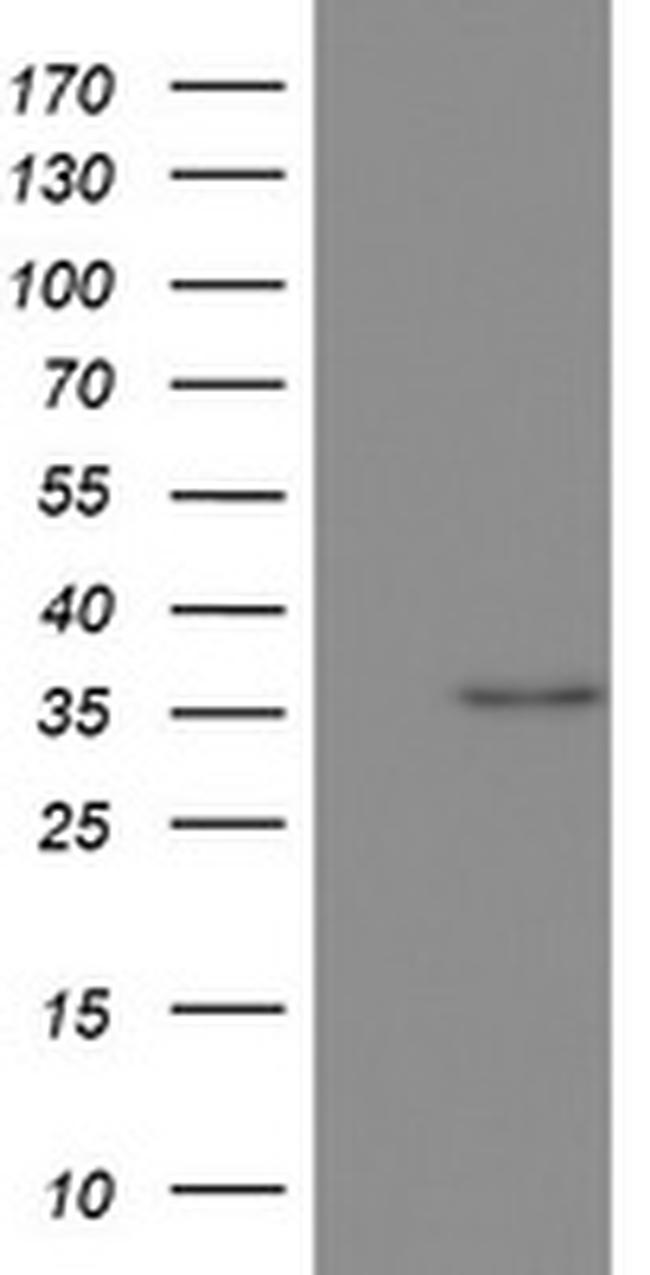 OTC Antibody in Western Blot (WB)