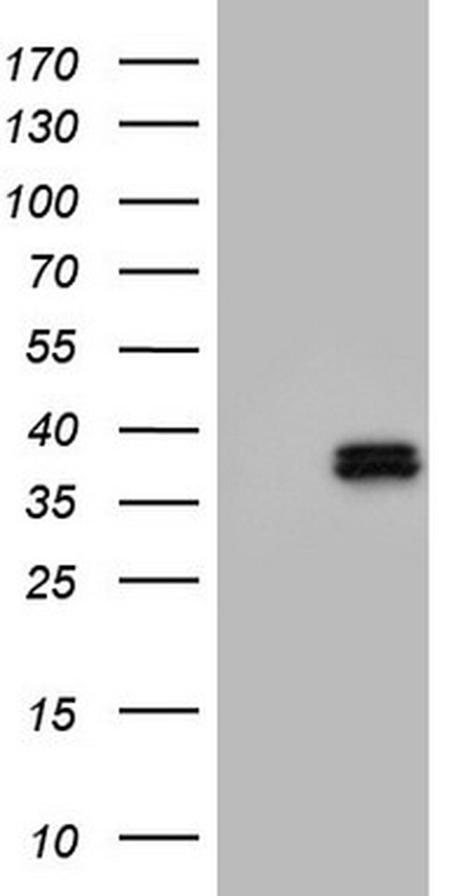 OTC Antibody in Western Blot (WB)
