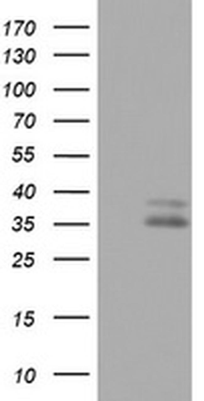 OTC Antibody in Western Blot (WB)