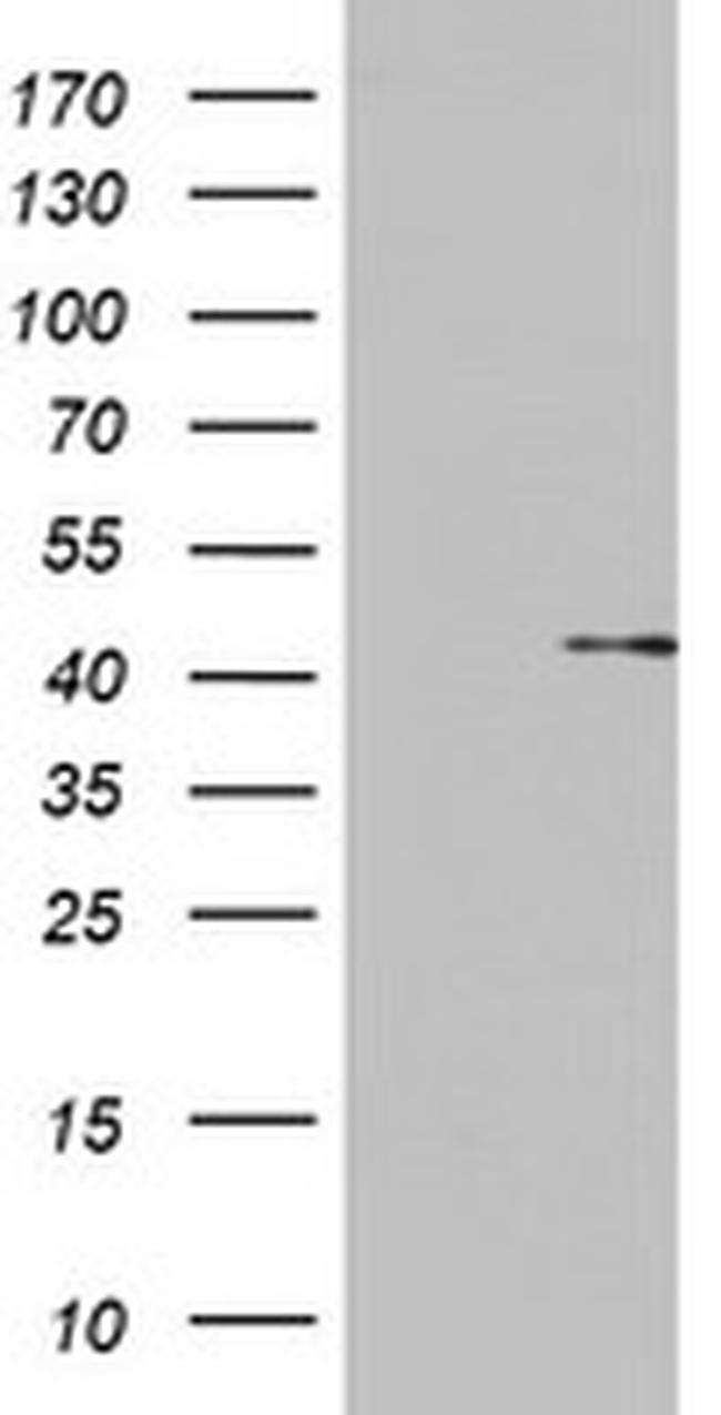 OTC Antibody in Western Blot (WB)