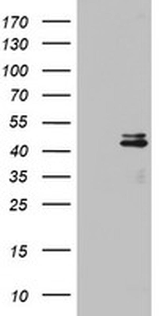 OTC Antibody in Western Blot (WB)