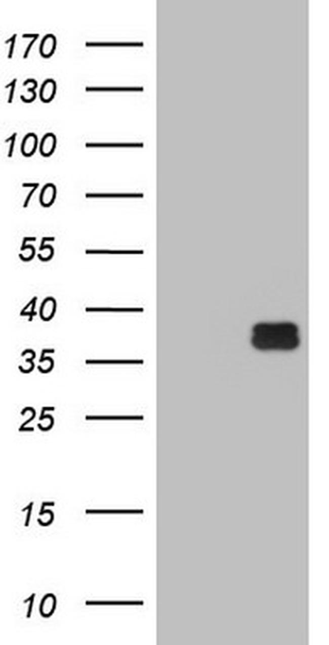 OTC Antibody in Western Blot (WB)