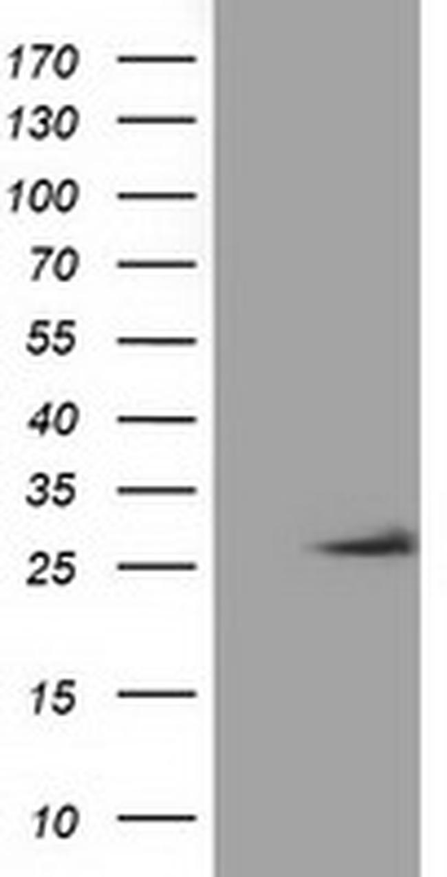OTUB2 Antibody in Western Blot (WB)