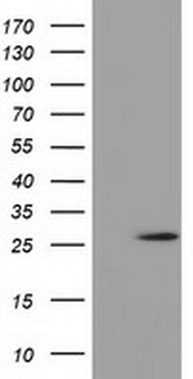 OTUB2 Antibody in Western Blot (WB)