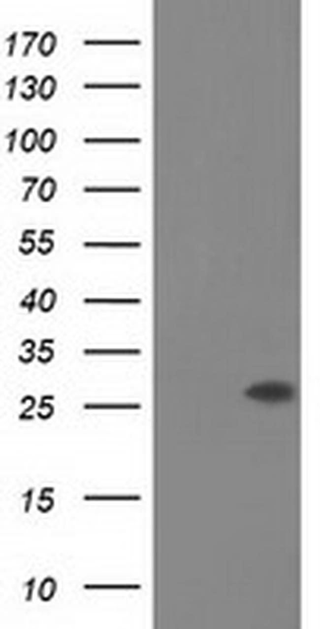 OTUB2 Antibody in Western Blot (WB)