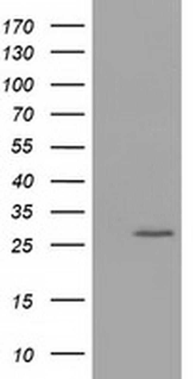OTUB2 Antibody in Western Blot (WB)