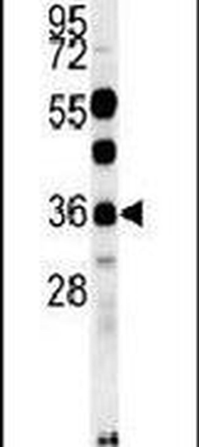 OTUD6B Antibody in Western Blot (WB)
