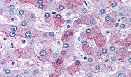 OXER1 Antibody in Immunohistochemistry (Paraffin) (IHC (P))