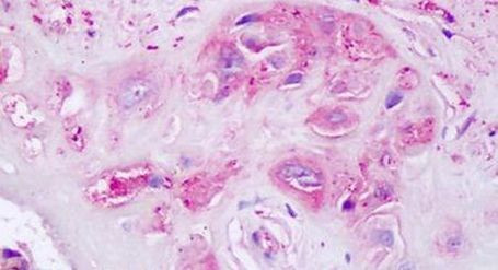 Oxytocin Receptor Antibody in Immunohistochemistry (Paraffin) (IHC (P))