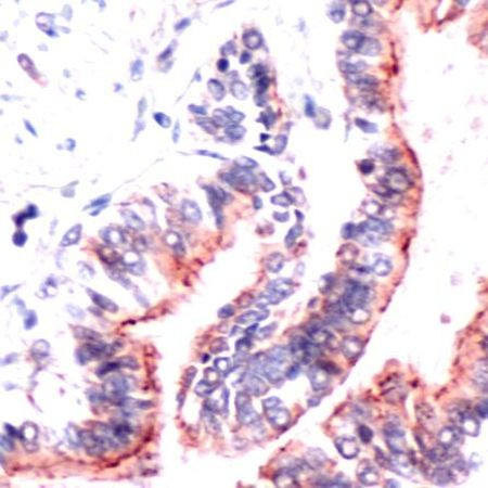 Occludin Antibody in Immunohistochemistry (IHC)