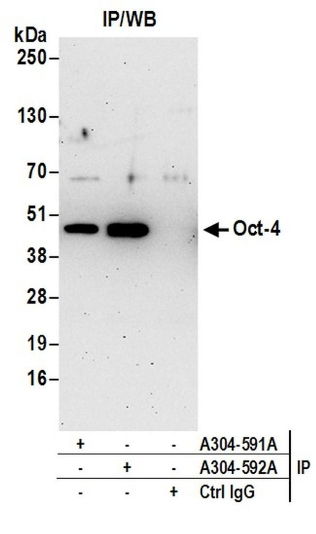 Oct 4 Polyclonal Antibody A304 592A T oct-4-polyclonal-antibody-a304-592a-t