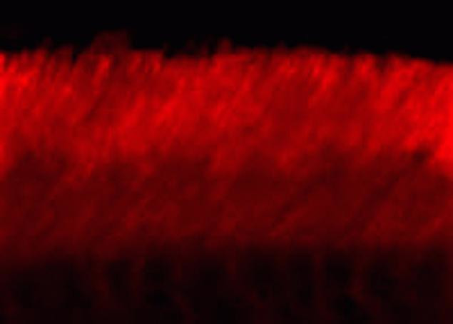 ABCA4 Antibody in Immunohistochemistry (IHC)