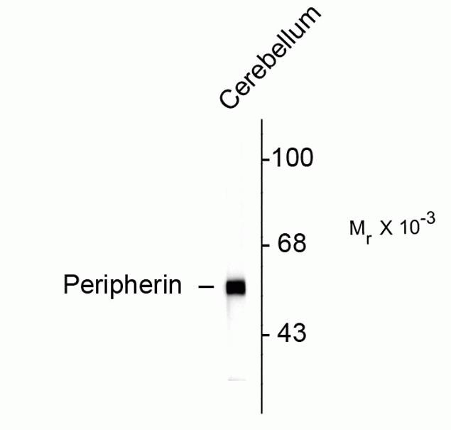 Peripherin Antibody in Western Blot (WB)