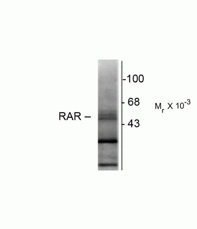 RARB Antibody in Western Blot (WB)