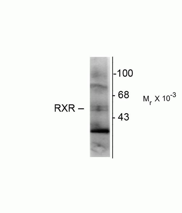 RXRG Antibody in Western Blot (WB)