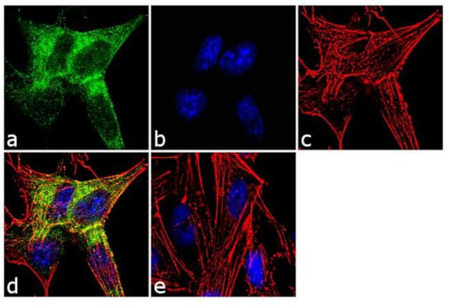 VAMP1 Antibody in Immunocytochemistry (ICC/IF)