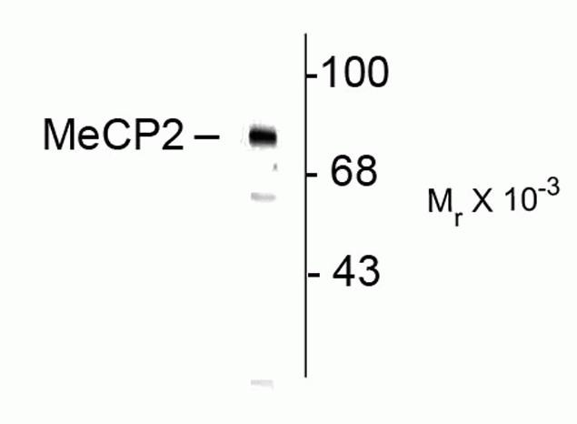 Phospho-MECP2 (Ser80) Antibody in Western Blot (WB)