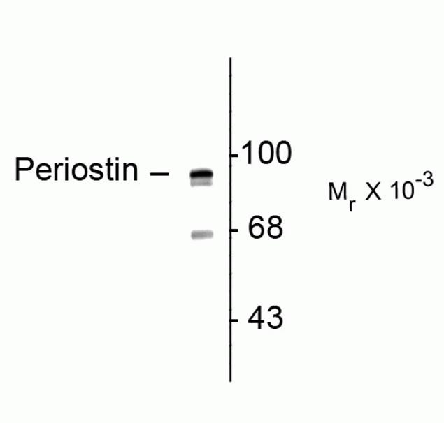 Periostin Antibody in Western Blot (WB)