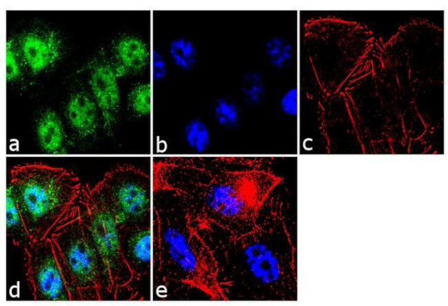 TR2 Antibody in Immunocytochemistry (ICC/IF)
