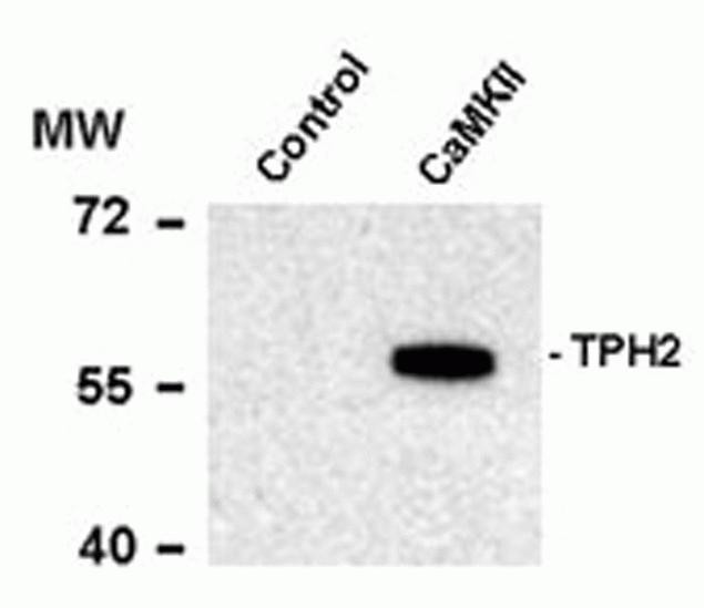 Phospho-TPH2 (Ser19) Antibody in Western Blot (WB)