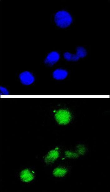 p21 Antibody in Immunocytochemistry (ICC/IF)