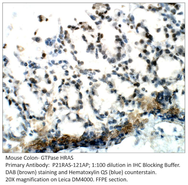 GTPase HRAS Antibody in Immunohistochemistry (IHC)