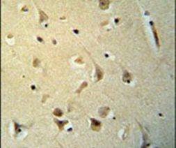 PPP2R3C Antibody in Immunohistochemistry (IHC)