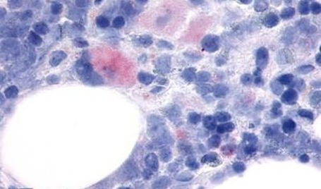 P2Y12 Antibody in Immunohistochemistry (Paraffin) (IHC (P))