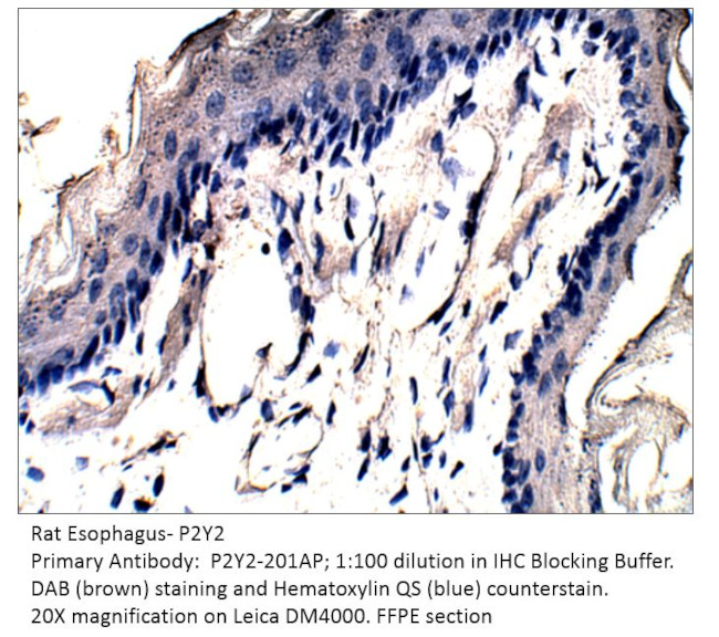 P2Y2 Antibody in Immunohistochemistry (IHC)