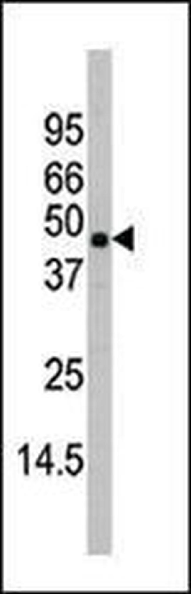 p38 MAPK beta Antibody in Western Blot (WB)