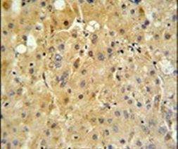 Cytochrome P450 Reductase Antibody in Immunohistochemistry (IHC)