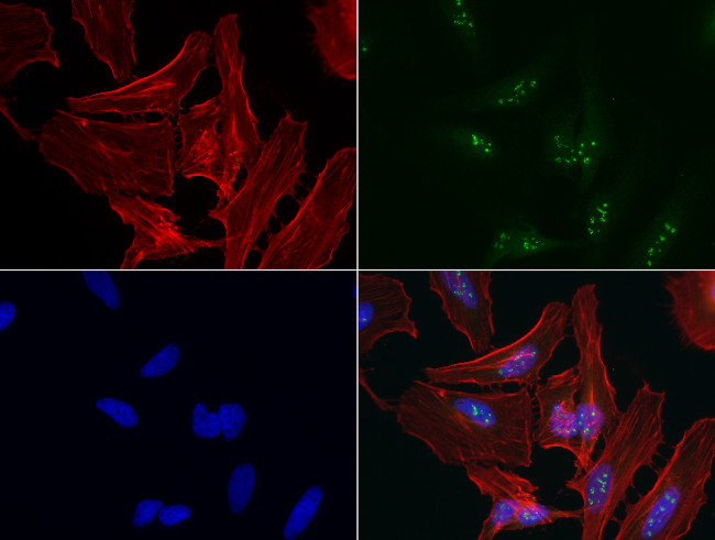 P53 Antibody in Immunocytochemistry (ICC/IF)