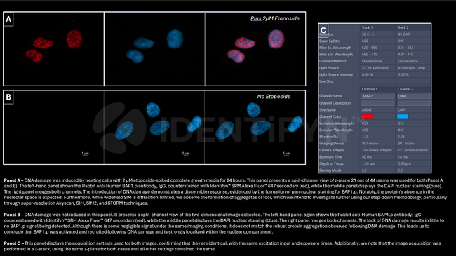 BAP1.p Antibody in Immunocytochemistry (ICC/IF)