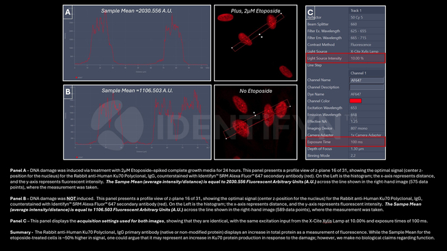 Ku70 Antibody in Immunocytochemistry (ICC/IF)