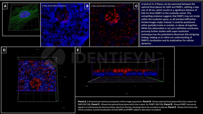 PARP1 Antibody in Immunocytochemistry (ICC/IF)