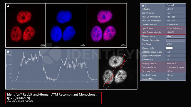 ATM Antibody in Immunocytochemistry (ICC/IF)