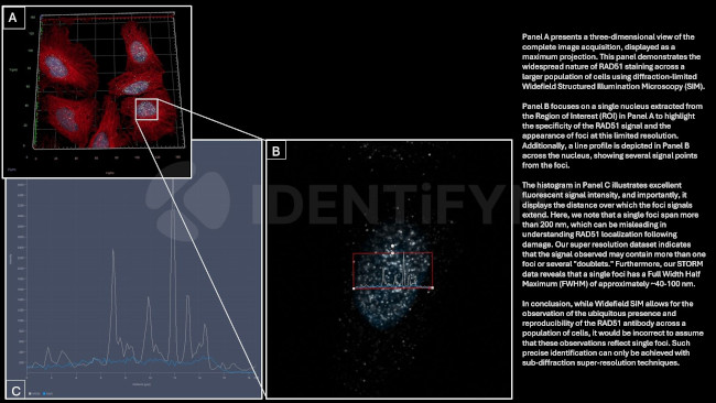 RAD51 SRM Antibody in Immunocytochemistry (ICC/IF)