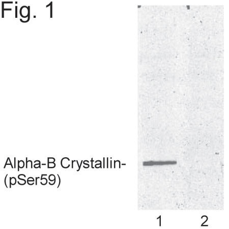 Phospho-CRYAB (Ser59) Antibody in Western Blot (WB)