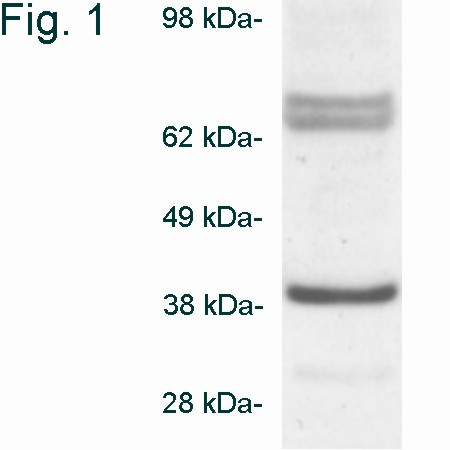 Biliverdin Reductase Antibody in Western Blot (WB)