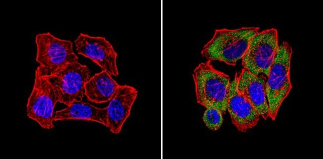 CPEB1 Antibody in Immunocytochemistry (ICC/IF)