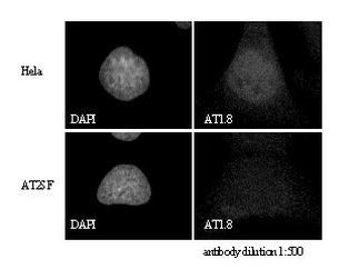 ATM Antibody in Immunohistochemistry (IHC)