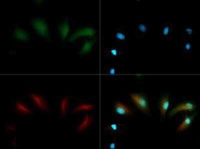 PHD2 Antibody in Immunocytochemistry (ICC/IF)