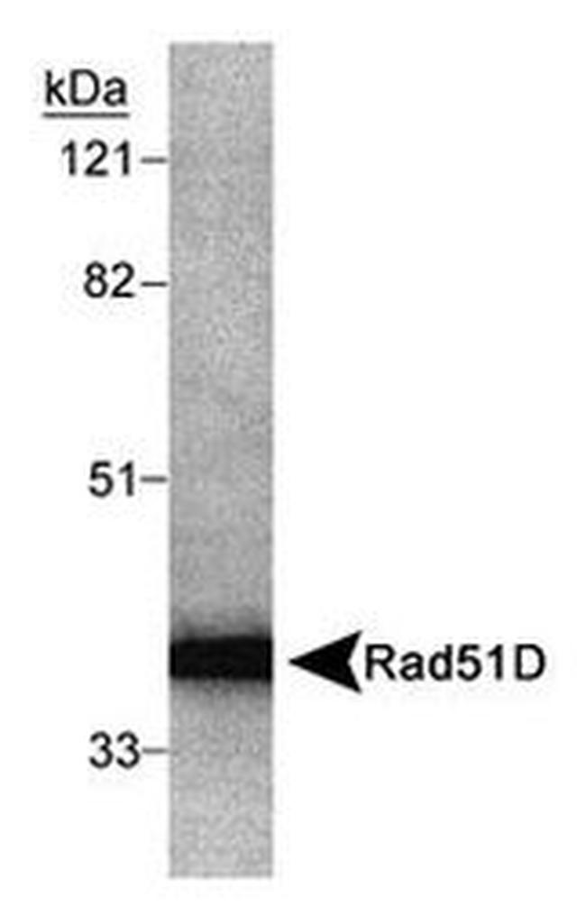 RAD51D Antibody in Western Blot (WB)