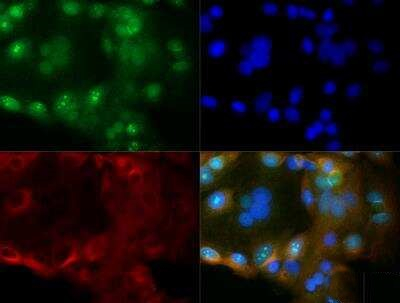 CYR61 Antibody in Immunocytochemistry (ICC/IF)