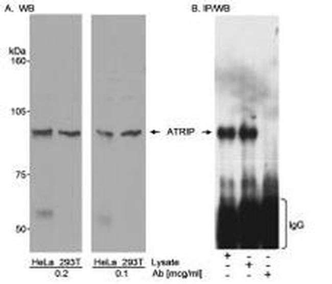 ATRIP Antibody in Western Blot (WB)