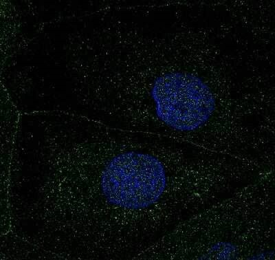 ATP7B Antibody in Immunocytochemistry (ICC/IF)