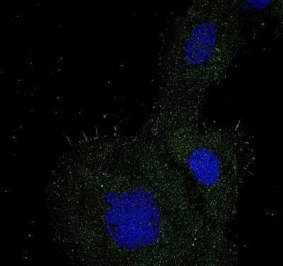 Carbonic Anhydrase IX Antibody in Immunocytochemistry (ICC/IF)